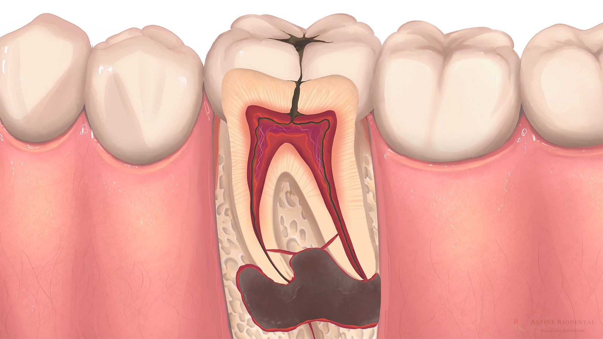 Representative 3D images of the root canal system and the outer tooth