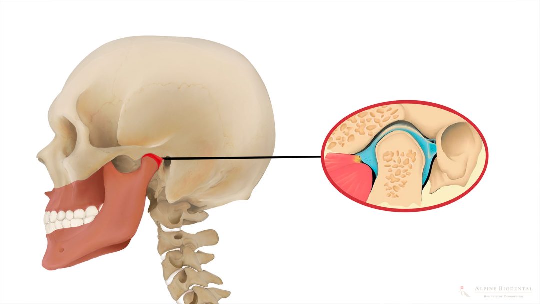 Kieferschmerzen